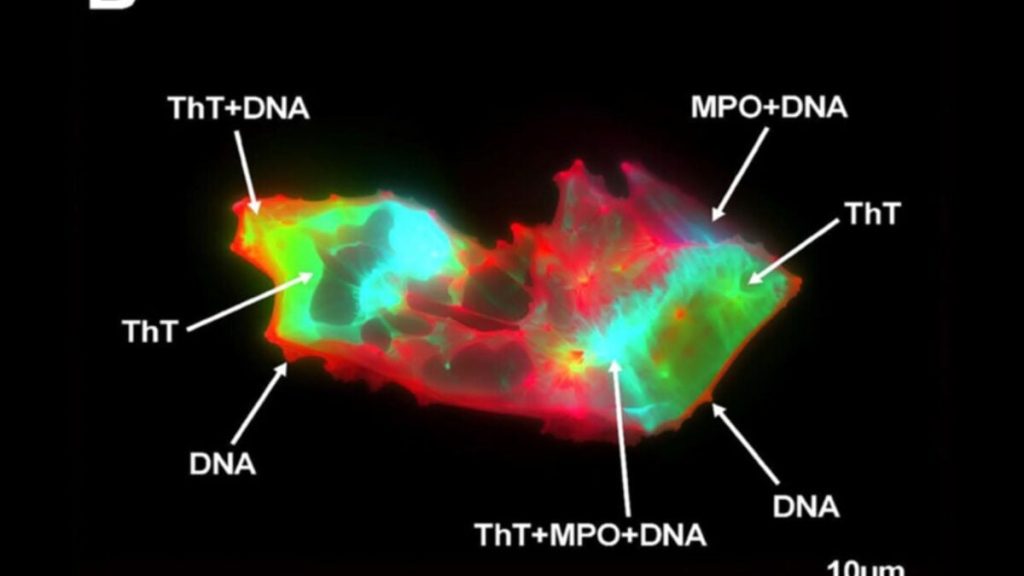People With Long Covid Have This Freaky-Looking Thing in Their Blood People With Long Covid Have This Freaky-Looking Thing in Their Blood